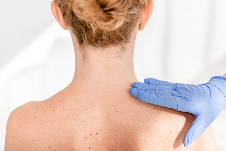 hair loss and skin disease