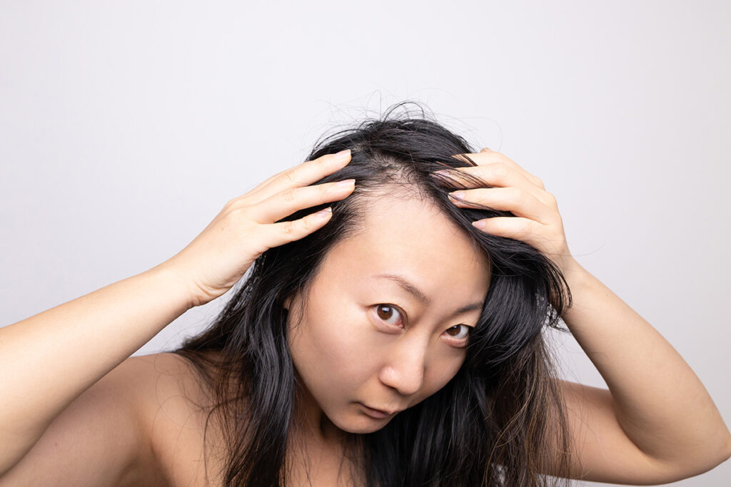 Women'S Hair Loss After Pregnancy: A Research-Based Overview 1 postpartum hair loss
