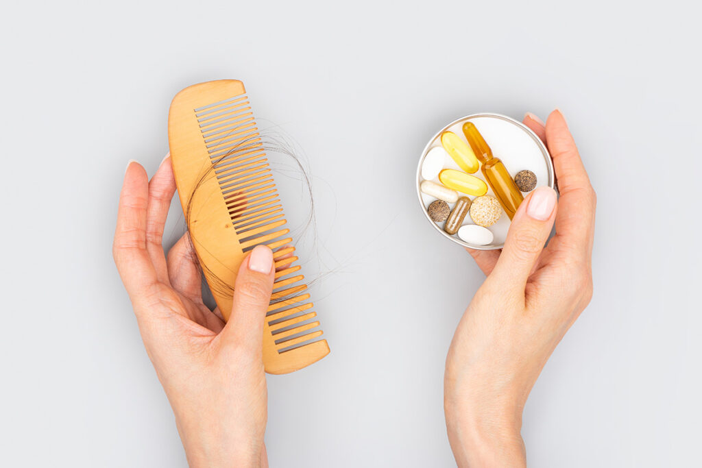 Vitamins, Minerals, And Supplements For Hair Loss: A Research Study 1 vitamins, for hair loss