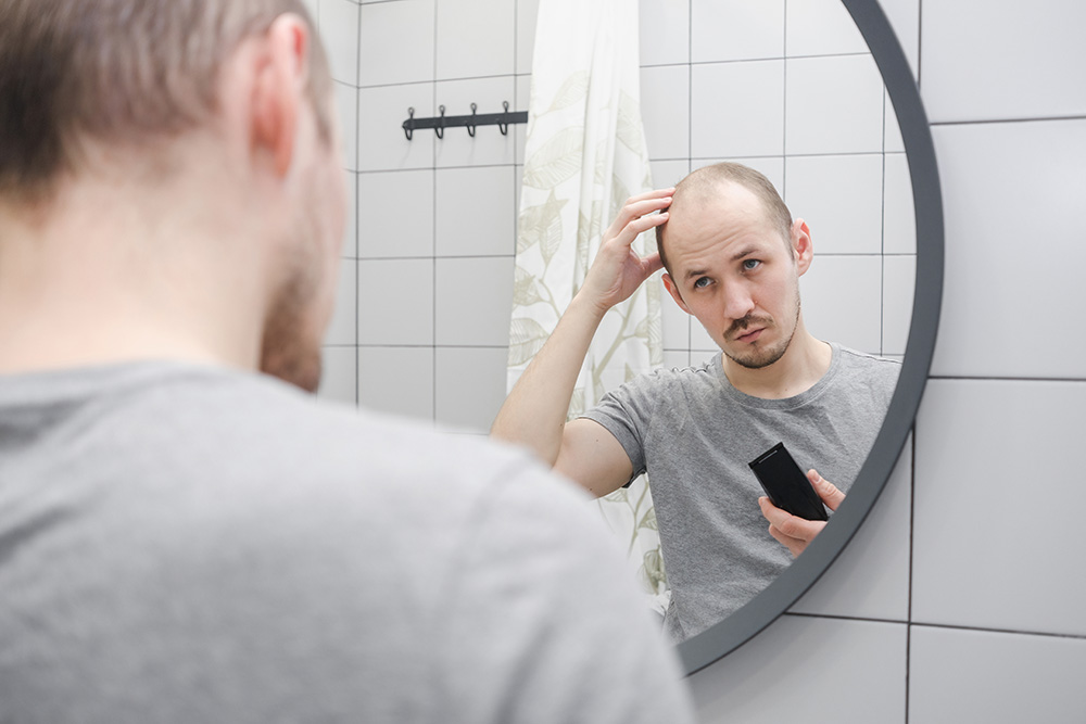 Men hair loss