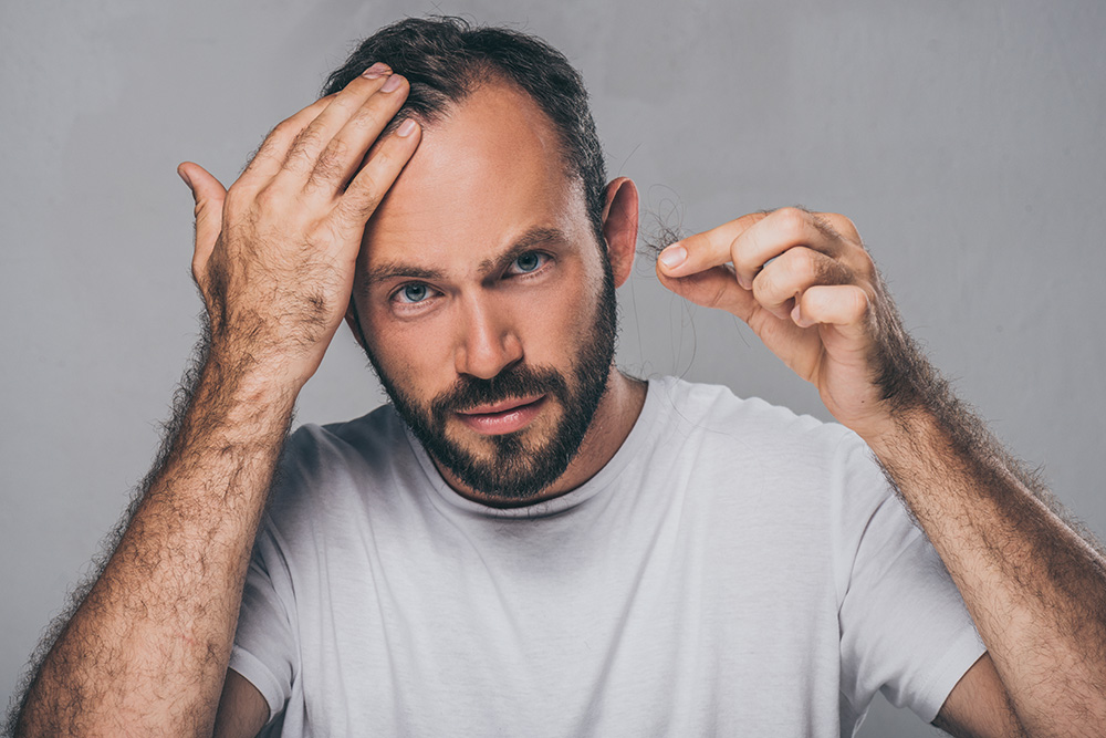 Hair loss problem