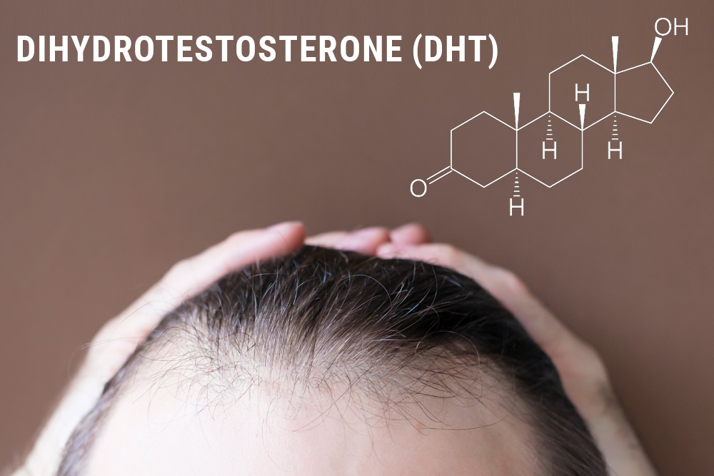 dihydrotestosterone DHT