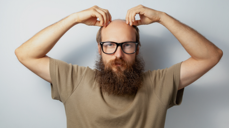 how i stopped my hair from thinning feature image