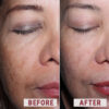 Before after comparison 2