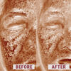 Before after comparison 1