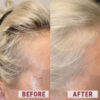 Before after hair loss