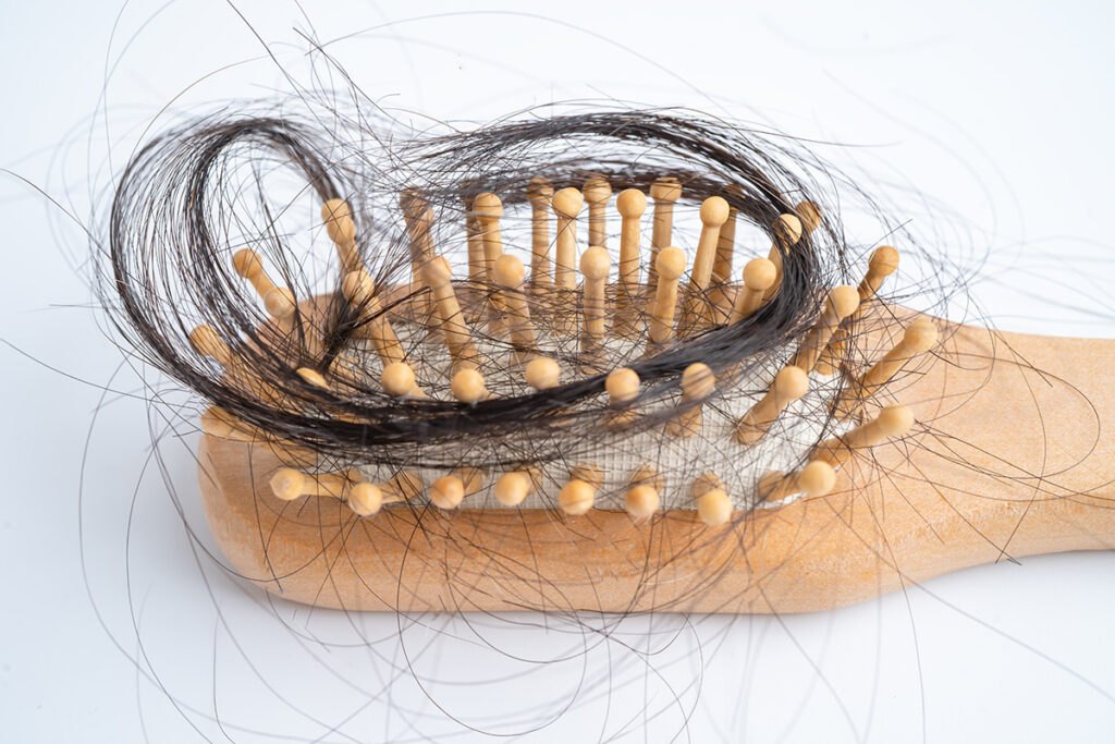 How Do I Stop My Hair From Shedding So Much?  1 hair shedding, hair loss.fall with comb,bush, serious problem,heal