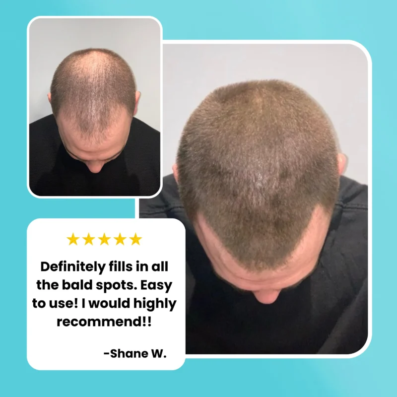surethik hair thickening fibers – keratin fibers for full hair coverage