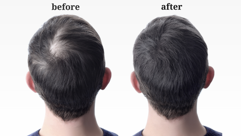 Hair Fibers: Your Ultimate Guide To Thicker, Fuller Hair In Minutes 2 hair fibers – instantly thicken hair and conceal thinning areas