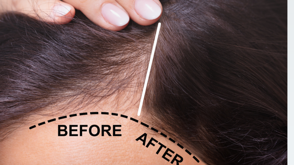 Hair Fibers: Your Ultimate Guide To Thicker, Fuller Hair In Minutes 3 hair fibers – natural-looking coverage for thinning hair