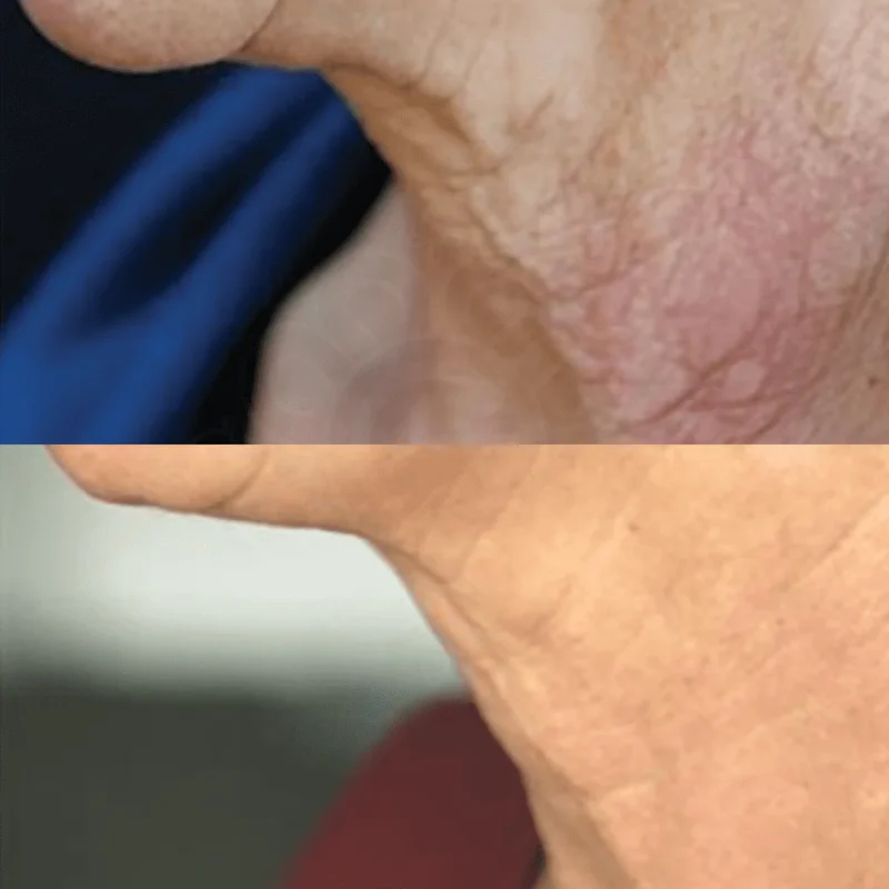anti-aging nitric oxide activating serum - image 5