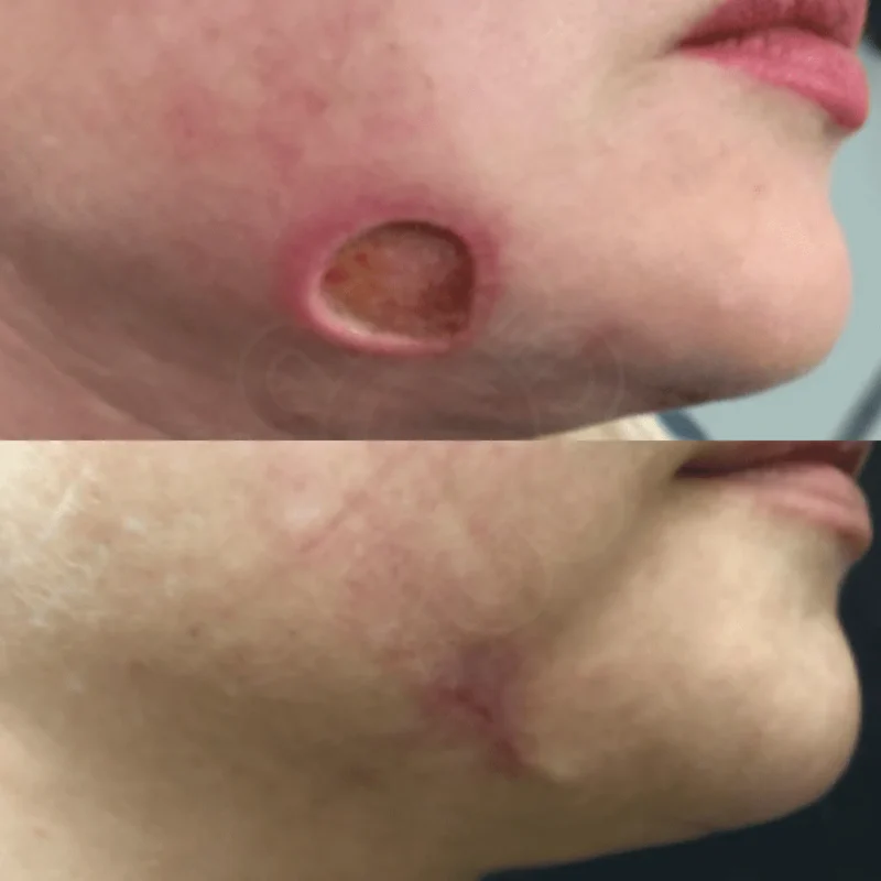 anti-aging nitric oxide activating serum - image 7