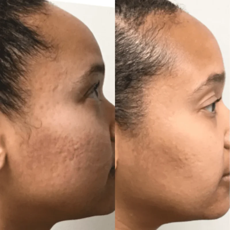 anti-aging nitric oxide activating serum - image 6