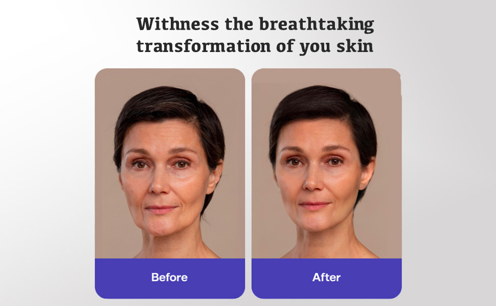 Before and after using skin serum results